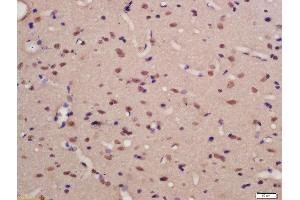 Formalin-fixed and paraffin embedded rat brain labeled with Rabbit Anti-TNIK (Ser769) Polyclonal Antibody, Unconjugated (ABIN711956) at 1:200 followed by conjugation to the secondary antibody and DAB staining (TNIK 抗体  (pSer769))