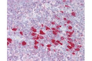 Anti-DLX5 antibody IHC of human thymus. (DLX5 抗体  (AA 71-120))