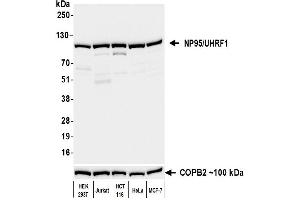 Western Blotting (WB) image for anti-Ubiquitin-Like, Containing PHD and RING Finger Domains, 1 (UHRF1) (AA 1-50) antibody (ABIN7795824)