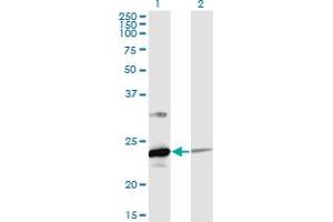 Western Blot analysis of UBE2T expression in transfected 293T cell line by UBE2T monoclonal antibody (M02), clone 4G1-4C2. (Ube2t 抗体  (AA 1-197))