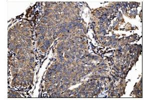 IHC analysis of AS160/TBC1D4 using anti-AS160/TBC1D4 antibody (ABIN7599745). (TBC1D4 抗体  (AA 1118-1298))