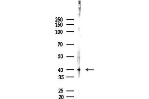 Western blot analysis of lysates from LoVo cells(heat-shock,45 min treatment), using HLA-H Antibody at 1/1000 dilution.