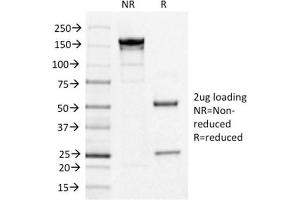 SDS-PAGE Analysis Purified IL3RA/CD123 Mouse Monoclonal Antibody (IL3RA/1531). (IL3RA 抗体  (AA 26-171))