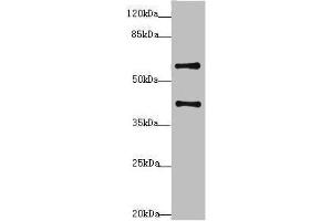 Western blot All lanes: SYCE1 antibody at 3. (SYCE1 抗体  (AA 132-351))