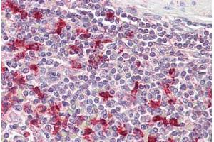 Anti-PTMA antibody IHC staining of human spleen. (PTMA 抗体  (AA 89-101))