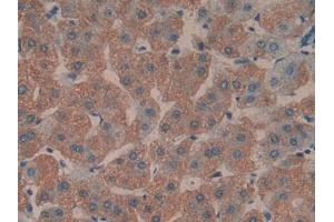 DAB staining on IHC-P; Samples: Human Liver Tissue (TOLLIP 抗体  (AA 28-261))