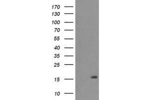 Western Blotting (WB) image for anti-Chromosome 20 Open Reading Frame 30 (C20orf30) antibody (ABIN1498766) (C20orf30 抗体)