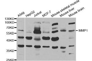 Western blot analysis of extracts of various cell lines, using MMP1 antibody. (MMP1 抗体  (AA 20-280))
