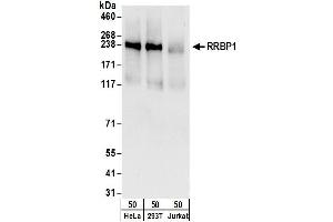 anti-Ribosome Binding Protein 1 (RRBP1) (AA 675-725) antibody