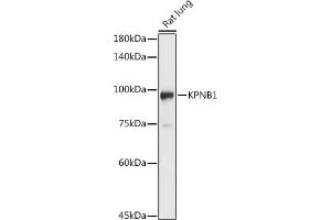 Western blot analysis of extracts of Rat lung, using KPNB1 antibody (ABIN6134722, ABIN6142997, ABIN6142998 and ABIN6224723) at 1:1000 dilution. (KPNB1 抗体  (AA 250-350))