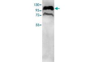 Western blot analysis of HepG2 cell lysate with PPP1R10 polyclonal antibody  at 1 : 500 dilution. (PPP1R10 抗体  (AA 661-929))