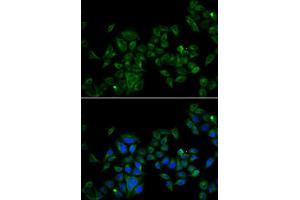 Immunofluorescence analysis of U2OS cell using MAGED1 antibody. (MAGED1 抗体)