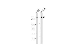 All lanes : Anti-FANCM Antibody (C-Term) at 1:2000 dilution Lane 1: Hela whole cell lysate Lane 2: U-2OS whole cell lysate Lysates/proteins at 20 μg per lane. (FANCM 抗体  (AA 1752-1783))