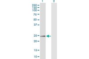 Western Blot analysis of RRAS expression in transfected 293T cell line by RRAS MaxPab polyclonal antibody. (R-Ras 抗体  (AA 1-218))