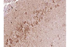 Paraformaldehyde-fixed, paraffin embedded Rat brain Antigen retrieval by boiling in sodium citrate buffer (pH6. (FKBP5 抗体  (AA 201-300))