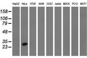 Western blot analysis of extracts (35 µg) from 9 different cell lines by using anti-GSTT2 monoclonal antibody. (GSTT2 抗体)