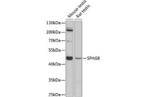 Western blot analysis of extracts of various cell lines, using SP antibody (ABIN6129712, ABIN6148323, ABIN6148324 and ABIN6224831) at 1:3000 dilution. (SPAG8 抗体  (AA 220-420))
