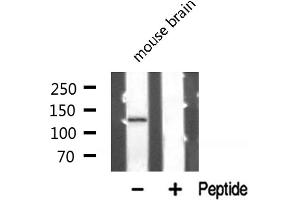 Western blot analysis of PKCB1 expression in Mouse brain lysate (ZMYND8 抗体  (Internal Region))