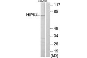 Western Blotting (WB) image for anti-Homeodomain Interacting Protein Kinase 4 (HIPK4) (AA 511-560) antibody (ABIN2889676) (HIPK4 抗体  (AA 511-560))