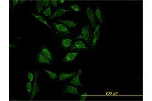 Immunofluorescence of monoclonal antibody to HTRA2 on HeLa cell. (HTRA2 抗体  (AA 359-458))