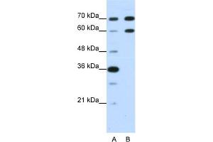 WB Suggested Anti-DMRT2 Antibody Titration:  1. (DMRT2 抗体  (N-Term))