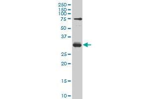 TGIF2 monoclonal antibody (M04), clone 5G6 Western Blot analysis of TGIF2 expression in Hela S3 NE . (TGIF2 抗体  (AA 131-236))