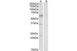 Image no. 1 for anti-Solute Carrier Family 7 (Cationic Amino Acid Transporter, Y+ System), Member 5 (SLC7A5) (AA 419-432) antibody (ABIN490361) (SLC7A5 抗体  (AA 419-432))