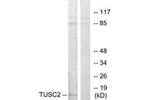 Western blot analysis of extracts from HeLa cells, using TUSC2 Antibody. (TUSC2 抗体  (AA 41-90))