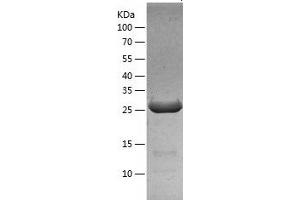 Western Blotting (WB) image for Fibroblast Growth Factor 5 (FGF5) (AA 18-268) protein (His tag) (ABIN7122944) (FGF5 Protein (AA 18-268) (His tag))