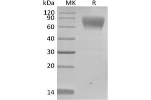 Western Blotting (WB) image for Trophoblast Glycoprotein (TPBG) protein (His tag,Biotin) (ABIN7319802) (TPBG Protein (His tag,Biotin))