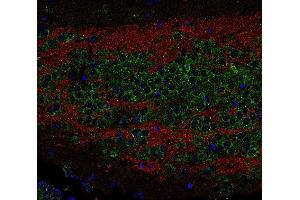 Indirect immunostaining of PFA fixed paraffin-embedded mouse hippocampus section with anti-SV 2C (dilution 1 : 200; red) and rabbit anti-sec 22b (, dilution 1 : 200; green). (SV2C 抗体  (AA 2-16))