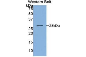Western blot analysis of the recombinant protein. (PNPLA2 抗体  (AA 481-702))