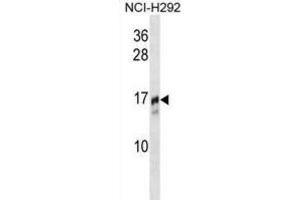 Western Blotting (WB) image for anti-Trafficking Protein Particle Complex 2 (TRAPPC2) antibody (ABIN2995169) (TRAPPC2 抗体)