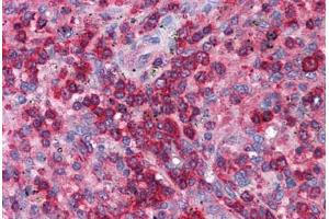 Human Spleen: Formalin-Fixed, Paraffin-Embedded (FFPE) (SNF8 抗体  (N-Term))