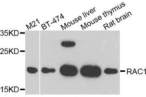 Western blot analysis of extract of various cells, using RAC1 antibody. (RAC1 抗体)