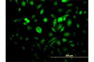 Immunofluorescence of purified MaxPab antibody to CENTA1 on HeLa cell. (ADAP1 抗体  (AA 1-374))