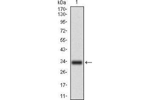 Western blot analysis using CD93 mAb against human CD93 recombinant protein. (CD93 抗体  (AA 474-535))