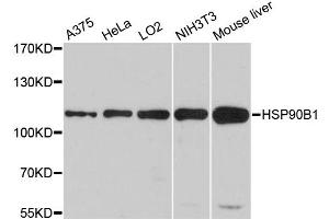 Western blot analysis of extracts of various cell lines, using HSP90B1 antibody. (GRP94 抗体)