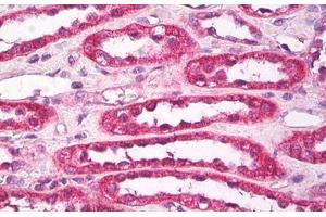 Image no. 1 for anti-Aquaporin 1 (Colton Blood Group) (AQP1) (AA 1-10) antibody (ABIN1494240) (Aquaporin 1 抗体  (AA 1-10))