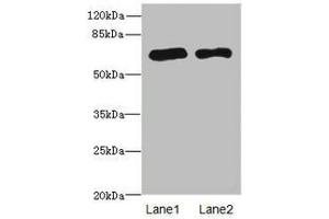 Western blot All lanes: PPM1Dantibody at 2. (PPM1D 抗体  (AA 1-250))