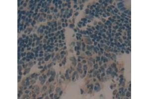 IHC-P analysis of Human Tissue, with DAB staining. (CCL21 抗体  (AA 24-134))