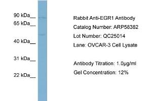 WB Suggested Anti-EGR1  Antibody Titration: 0. (EGR1 抗体  (Middle Region))
