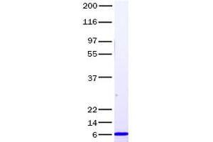 Validation with Western Blot (CXCL1 蛋白)