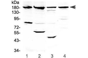 Western blot testing of 1) human PANC-1, 2) human placenta, 3) rat kidney and 4) mouse kidney lysate with ERBB4 antibody at 0. (ERBB4 抗体)