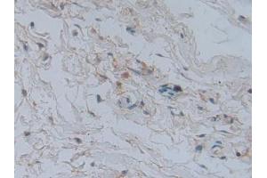 Used in DAB staining on fromalin fixed paraffin-embedded heart tissue (GLRX3 抗体  (AA 144-234))