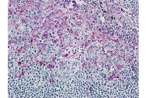 Immunohistochemical (Formalin/PFA-fixed paraffin-embedded sections) staining in human tonsil with CCR8 polyclonal antibody . (CCR8 抗体  (3rd Cytoplasmic Domain))