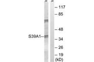 Western Blotting (WB) image for anti-Solute Carrier Family 39 (Zinc Transporter), Member 1 (SLC39A1) (AA 111-160) antibody (ABIN2890707) (SLC39A1 抗体  (AA 111-160))