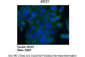 Immunohistochemistry (IHC) image for anti-Aconitase 1 (ACO1) (N-Term) antibody (ABIN2778793)
