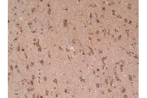 Detection of EZH2 in Human Brain Tissue using Polyclonal Antibody to Enhancer Of Zeste Homolog 2 (EZH2) (EZH2 抗体  (AA 51-285))