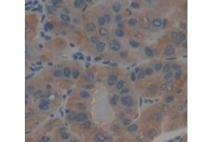 IHC-P analysis of Human Tissue, with DAB staining. (DUSP6 抗体  (AA 1-300))